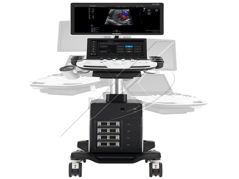 Ultrasound P11